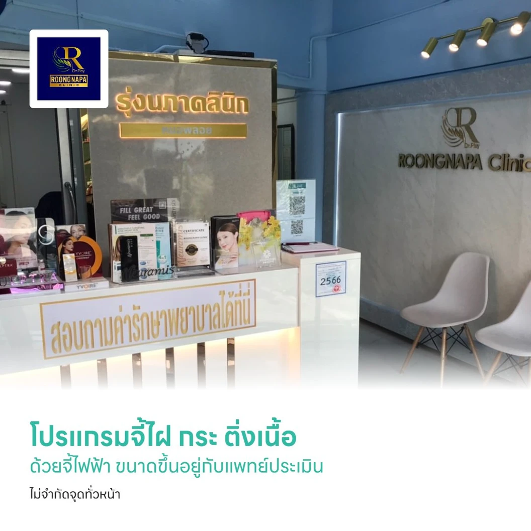 โปรแกรมจี้ไฝ กระ ติ่งเนื้อ ด้วยจี้ไฟฟ้า ขนาดขึ้นอยู่กับแพทย์ประเมิน ไม่จำกัดจุดทั่วหน้า