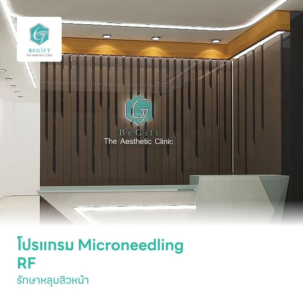 โปรแกรม Microneedling RF รักษาหลุมสิวหน้า