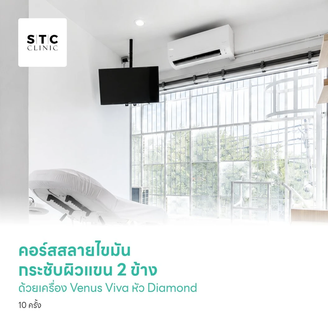 คอร์สสลายไขมัน กระชับผิวแขน 2 ข้างด้วยเครื่อง Venus Viva หัว Diamond 10 ครั้ง