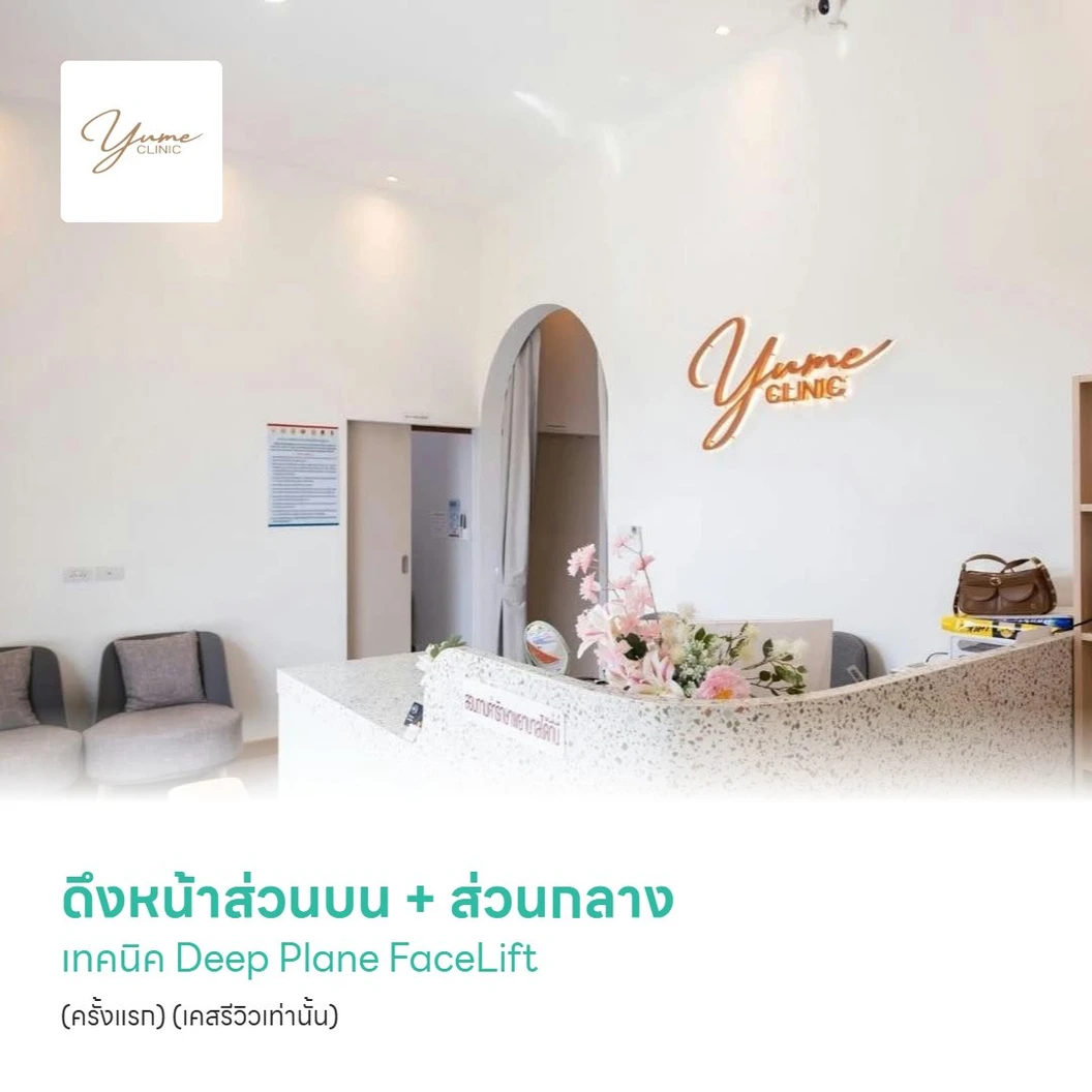 ดึงหน้าส่วนบน + ส่วนกลาง เทคนิค Deep Plane FaceLift (ครั้งแรก) (เคสรีวิวเท่านั้น)