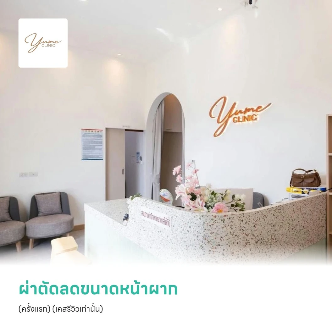 ผ่าตัดลดขนาดหน้าผาก (ครั้งแรก) (เคสรีวิวเท่านั้น)