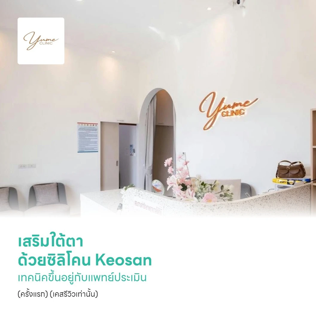 เสริมใต้ตา ด้วยซิลิโคน Keosan เทคนิคขึ้นอยู่กับแพทย์ประเมิน (ครั้งแรก) (เคสรีวิวเท่านั้น)