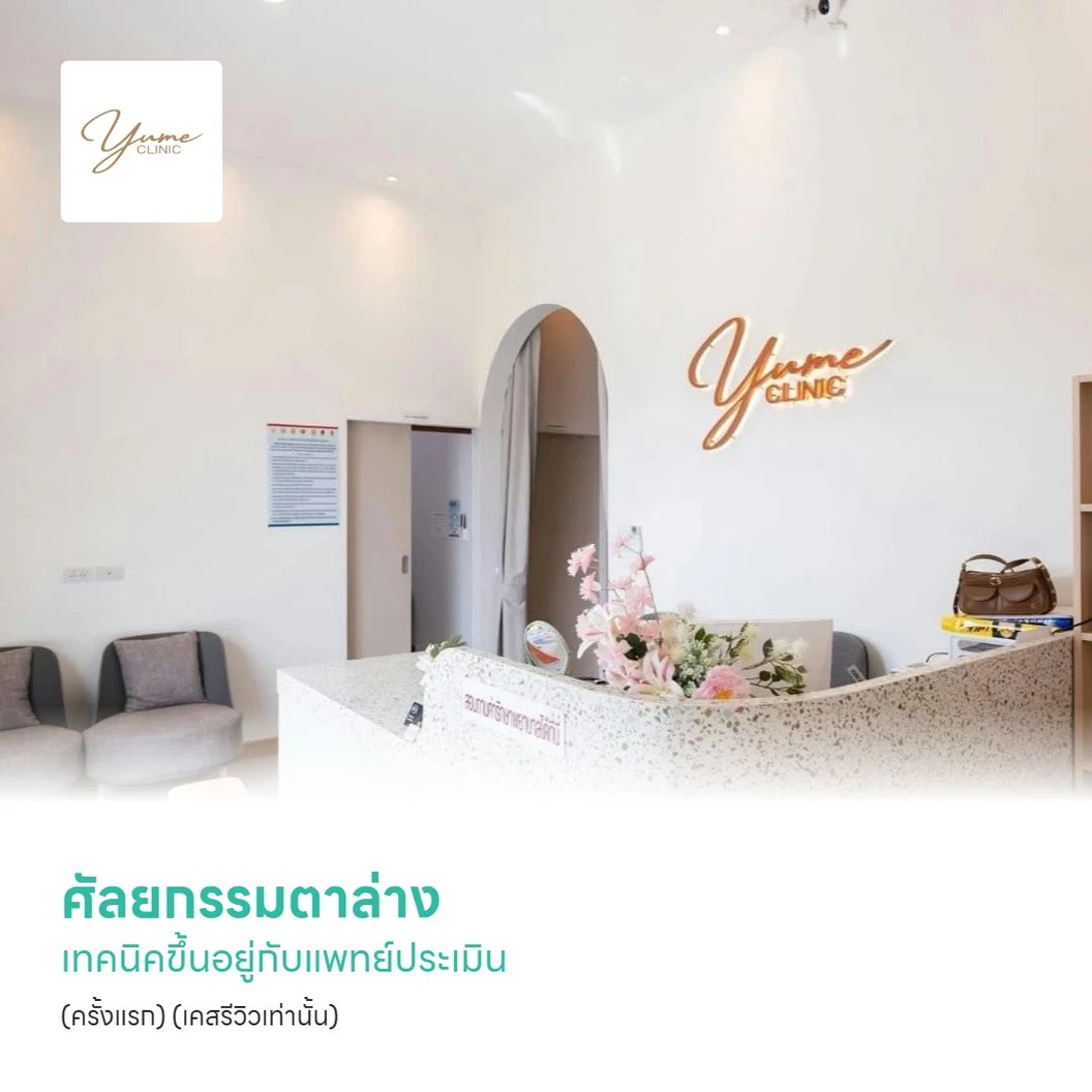 ศัลยกรรมตาล่าง เทคนิคขึ้นอยู่กับแพทย์ประเมิน (ครั้งแรก) (เคสรีวิวเท่านั้น)
