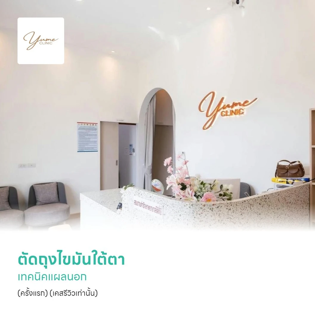 ตัดถุงไขมันใต้ตา เทคนิคแผลนอก (ครั้งแรก) (เคสรีวิวเท่านั้น)
