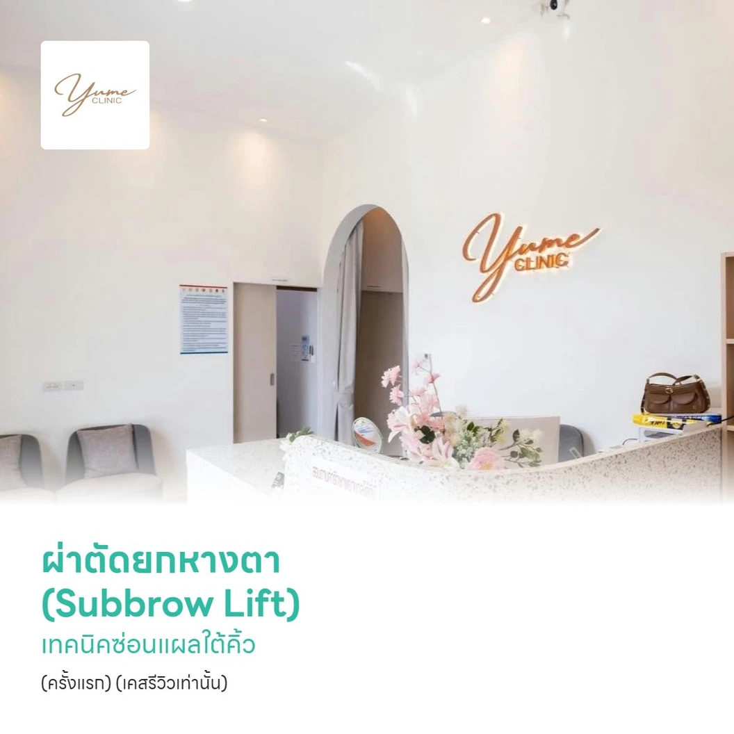 ผ่าตัดยกหางตา (Subbrow Lift) เทคนิคซ่อนแผลใต้คิ้ว (ครั้งแรก) (เคสรีวิวเท่านั้น)