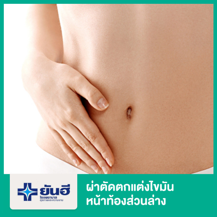 ตกแต่งไขมันหน้าท้องส่วนล่าง (Mini Abdominoplasty) ที่ โรงพยาบาลยันฮี - ราคา  2566 (2023) | Hdmall