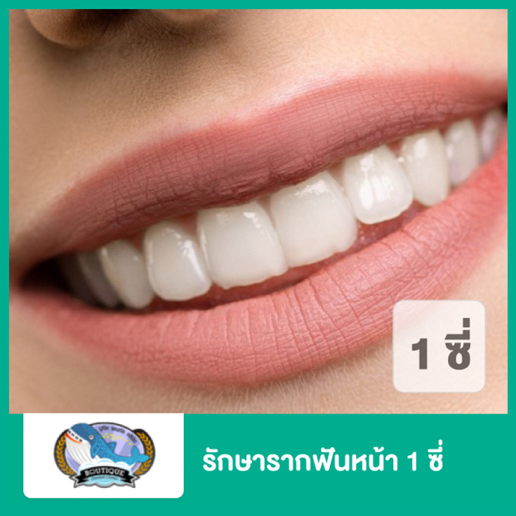 รักษารากฟันหน้า 1 ซี่ (ตามแพทย์ประเมิน) ที่ ศูนย์จัดฟัน รากเทียม  บูทีคเด็นทัล - ราคา 2566 (2023) | Hdmall