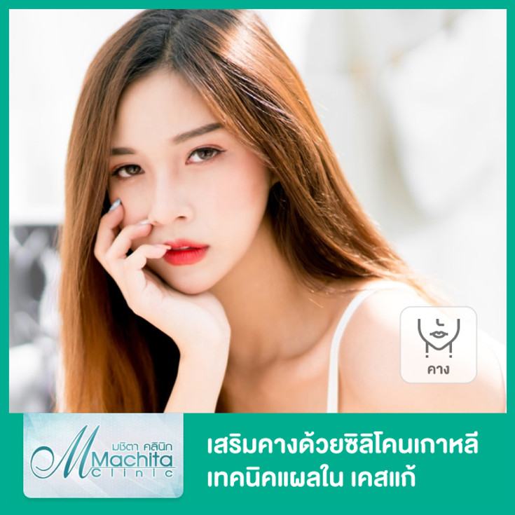 เสริมคางด้วยซิลิโคนเกาหลี เทคนิคแผลใน สำหรับเคสแก้ ที่ Machita Clinic -  ราคา 2566 (2023) | Hdmall