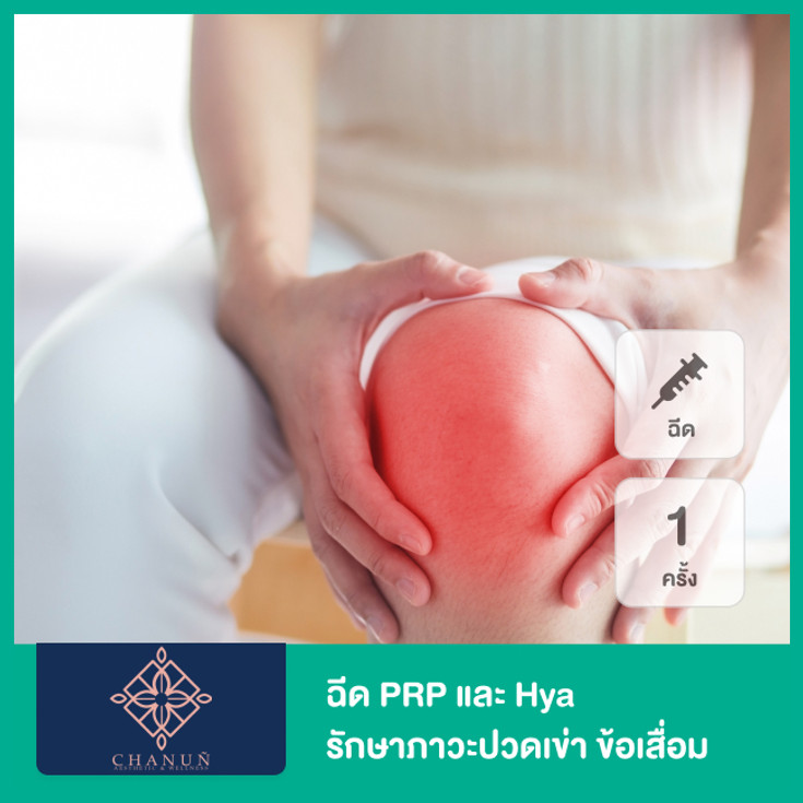 ฉีด Prp และ Hya รักษาภาวะปวดเข่า ข้อเสื่อม เข่าอักเสบ โปรแกรม Pure Hya Prps  Knee Therapy 1 ครั้ง ฟรี! ฉายแสงบริเวณหัวเข่า เพื่อลดบวม ลดอักเสบ 1 ครั...