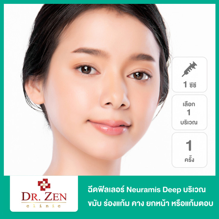 ฉีดฟิลเลอร์ Neuramis Deep 1 ซีซี เลือก 1 บริเวณ ขมับ ร่องแก้ม คาง ยก