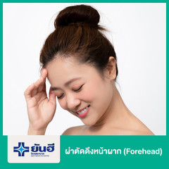 ดึงหน้าผาก (Forehead) ด้วย Endotine ที่ โรงพยาบาลยันฮี