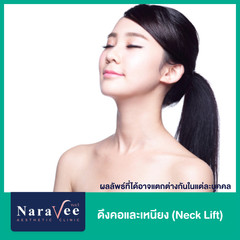 ดึงคอและเหนียง (Neck Lift) ด้วย Endotine ที่ Naravee Clinic (ณรวีคลินิก)