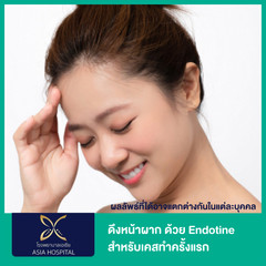 ดึงหน้าผาก ด้วย Endotine สำหรับเคสทำครั้งแรก ที่ โรงพยาบาลเอเซีย