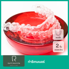 ทำรีเทนเนอร์แบบใส 2 ชิ้น ฟันบนและล่าง ที่ Ratchavipa Dental Clinic (คลินิกทันตกรรมรัชวิภา)
