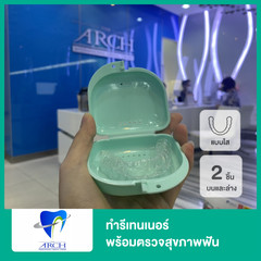 ทำรีเทนเนอร์แบบใส 2 ชิ้น (บนและล่าง) พร้อมตรวจสุขภาพฟัน ที่ The ARCH Dental Center (ศูนย์ทันตกรรมดิอาร์ช)