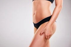 ดูดไขมันหน้าท้องส่วนล่าง