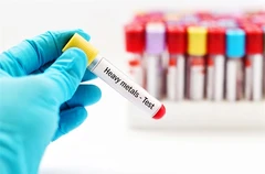 ตรวจโลหะหนักในเลือด 12 รายการ