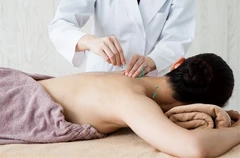 ฝังเข็มแบบตะวันตก (Dry needling) บรรเทาปวด 1 ครั้ง