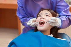 ขูดหินปูน พร้อมขัดฟันด้วยเครื่อง Air Flow