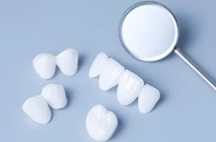 เคลือบผิวฟันและแปะฟันขาว ด้วยวีเนียร์เซรามิกหรือพอร์ซเลน EMax 1 ซี่