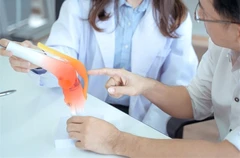 ผ่าตัดเปลี่ยนข้อเข่าเทียม และนอนพักใน รพ. 4 คืน 5 วัน