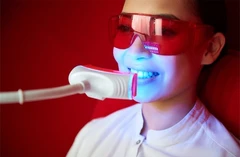 ฟอกสีฟันที่คลินิกด้วยระบบ Cool Light