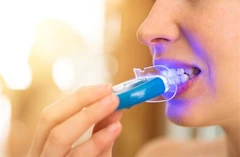 ชุดฟอกสีฟันที่บ้าน