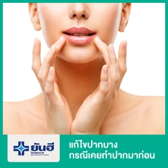 แก้ไขปากบาง กรณีเคยทำปากมาก่อน