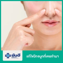 แก้ไขปีกจมูกที่เคยทำมา