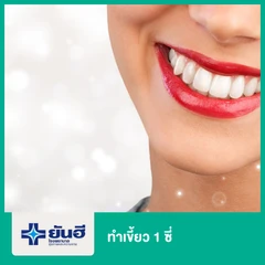 ทำเขี้ยว 1 ซี่