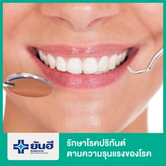 รักษาโรคปริทันต์ ตามความรุนแรงของโรค