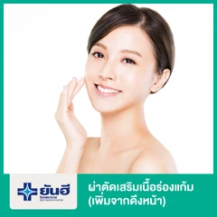 เสริมเนื้อร่องแก้ม (เพิ่มจากดึงหน้า)