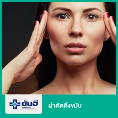 ดึงขมับ