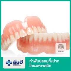 ทำฟันปลอมทั้งปาก โครงพลาสติก