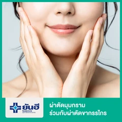 ผ่าตัดมุมกราม กรณีทำร่วมกับผ่าตัดขากรรไกร