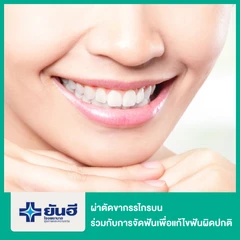 ผ่าตัดขากรรไกรบน กรณีทำร่วมกับการจัดฟันเพื่อแก้ไขฟันผิดปกติ