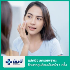 ผลัดผิว ลดรอยขรุขระ รักษาหลุมสิวบนใบหน้า ด้วย MD 1 ครั้ง