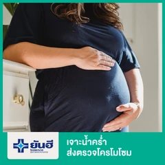 เจาะน้ำคร่ำ ส่งตรวจโครโมโซม (Amniotic Fluid Aspiration)