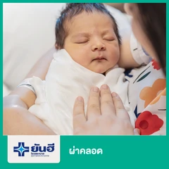 ผ่าคลอด