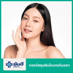 ถอดวัสดุเสริมโหนกแก้มออก