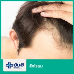 สักไรผม