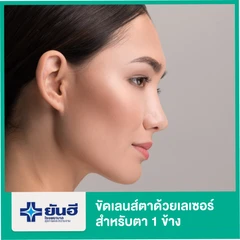 ขัดเลนส์ตาด้วยเลเซอร์ เทคนิค PRK สำหรับตา 1 ข้าง