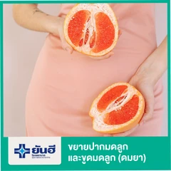 ขยายปากมดลูกและขูดมดลูก (ดมยา)