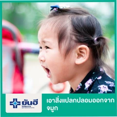 เอาสิ่งแปลกปลอมออกจากจมูก