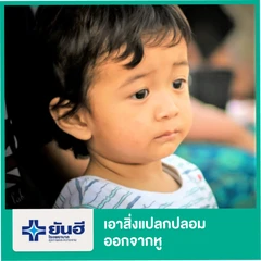 เอาสิ่งแปลกปลอมออกจากหู