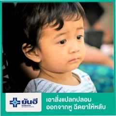 เอาสิ่งแปลกปลอมออกจากหู (ฉีดยาให้หลับ)