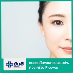 ลบรอยสักขอบตาบนและล่าง ด้วยเครื่อง Picoway