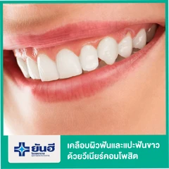 เคลือบผิวฟันและแปะฟันขาว ด้วยวีเนียร์คอมโพสิต (Composite Veneer) 1 ซี่