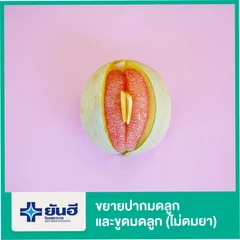 ขยายปากมดลูกและขูดมดลูก (ไม่ดมยา)