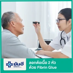ลอกต้อเนื้อ 2 หัว โดยใช้ Fibrin Glue